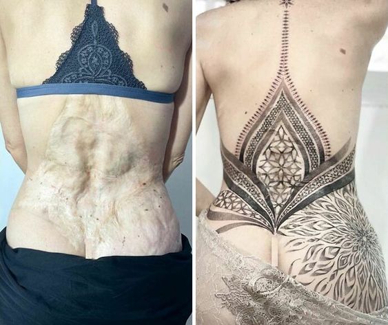 Can You Tattoo Over Scars? Everything About Tattooing Over Scars
